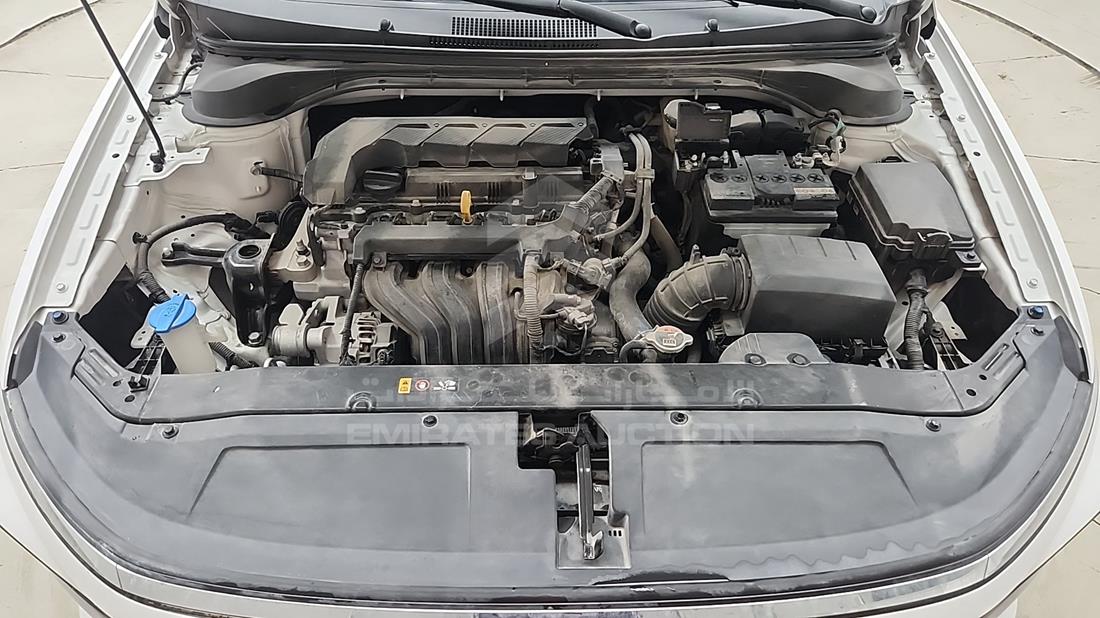 2025 Hyundai Accent — Engine Bay — Photo 31