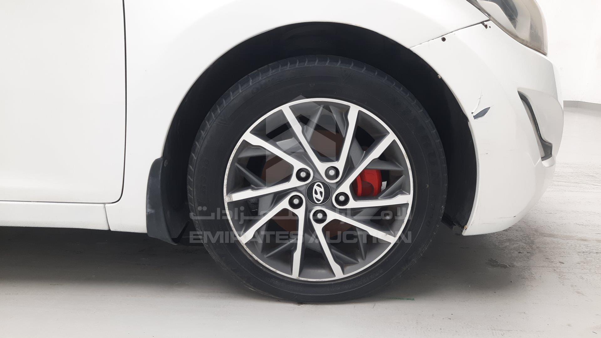 KMHDG41E3FU404728 - 2015 Hyundai Elantra - #461334