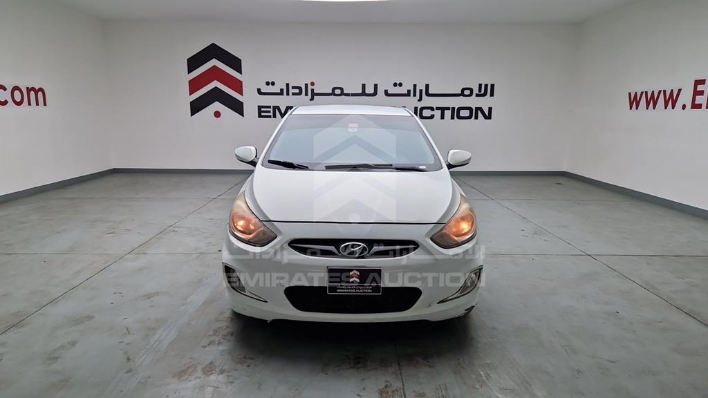 KMHCT41D0FU771794 - 2015 HYUNDAI ACCENT - #undefined