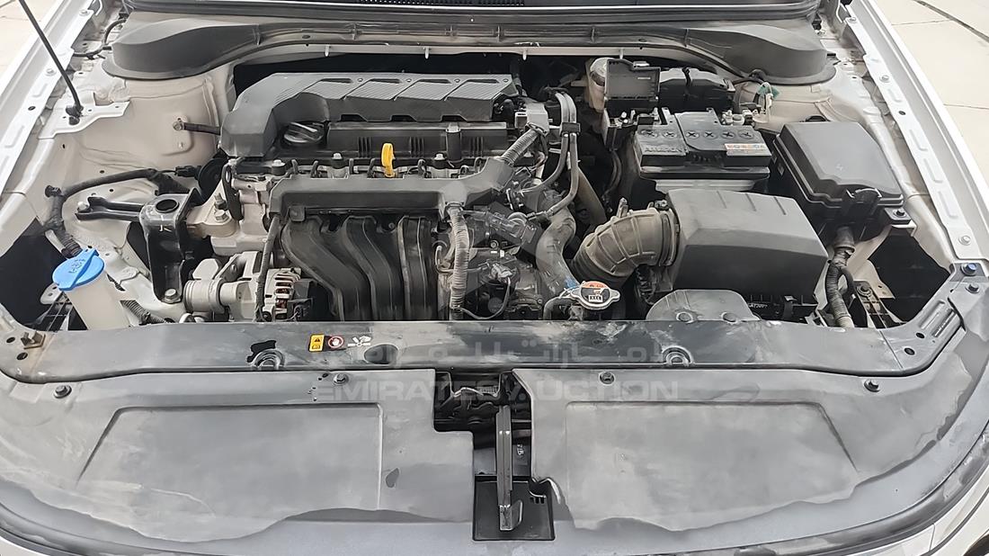 2025 Hyundai Accent — Engine Bay — Photo 32