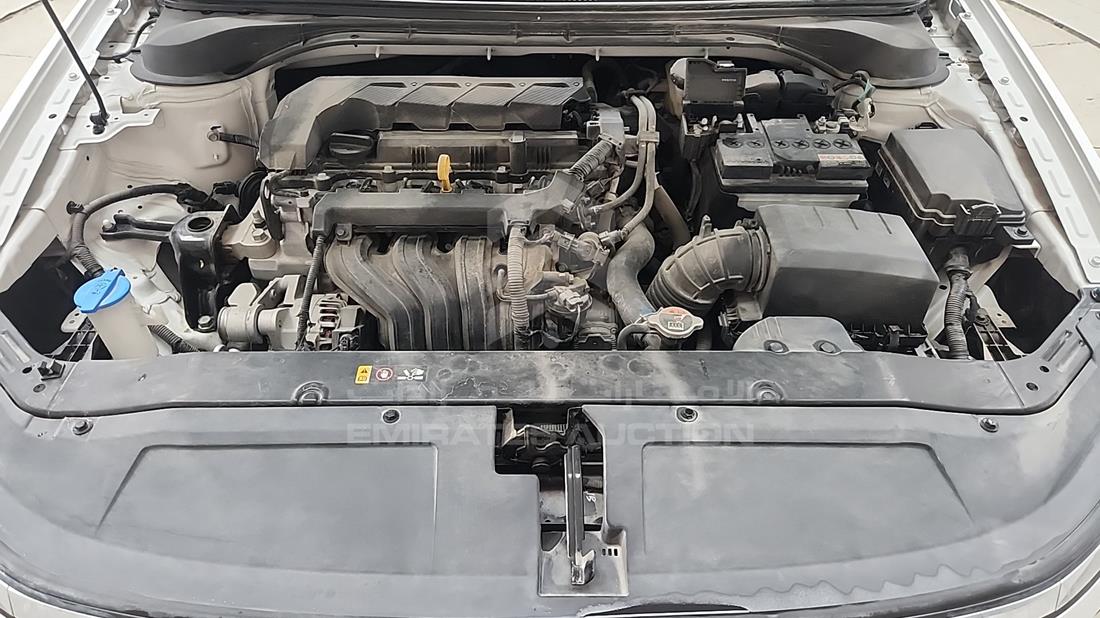 2025 Hyundai Accent — Engine Bay — Photo 32