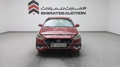 هيونداي اكسنت 2020