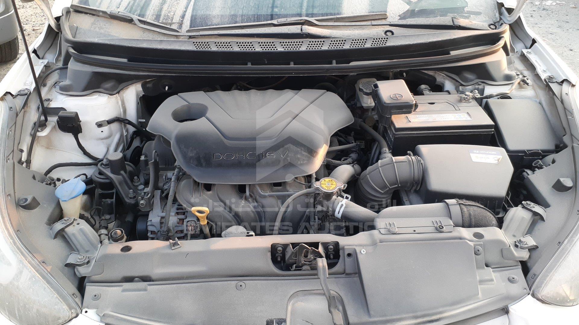 KMHDG41C7FU161827 - 2015 Hyundai Elantra - #502941