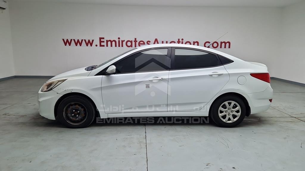 KMHCT41D0FU771794 - 2015 HYUNDAI ACCENT - #526180