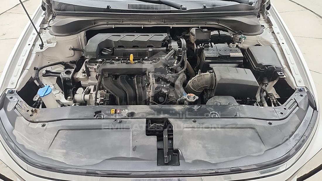 2025 Hyundai Accent — Engine Bay — Photo 31