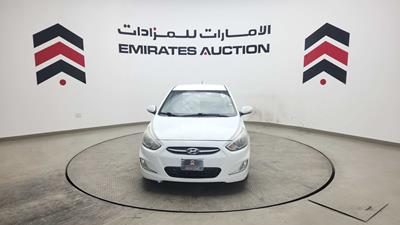 2017 Hyundai Accent - #667480