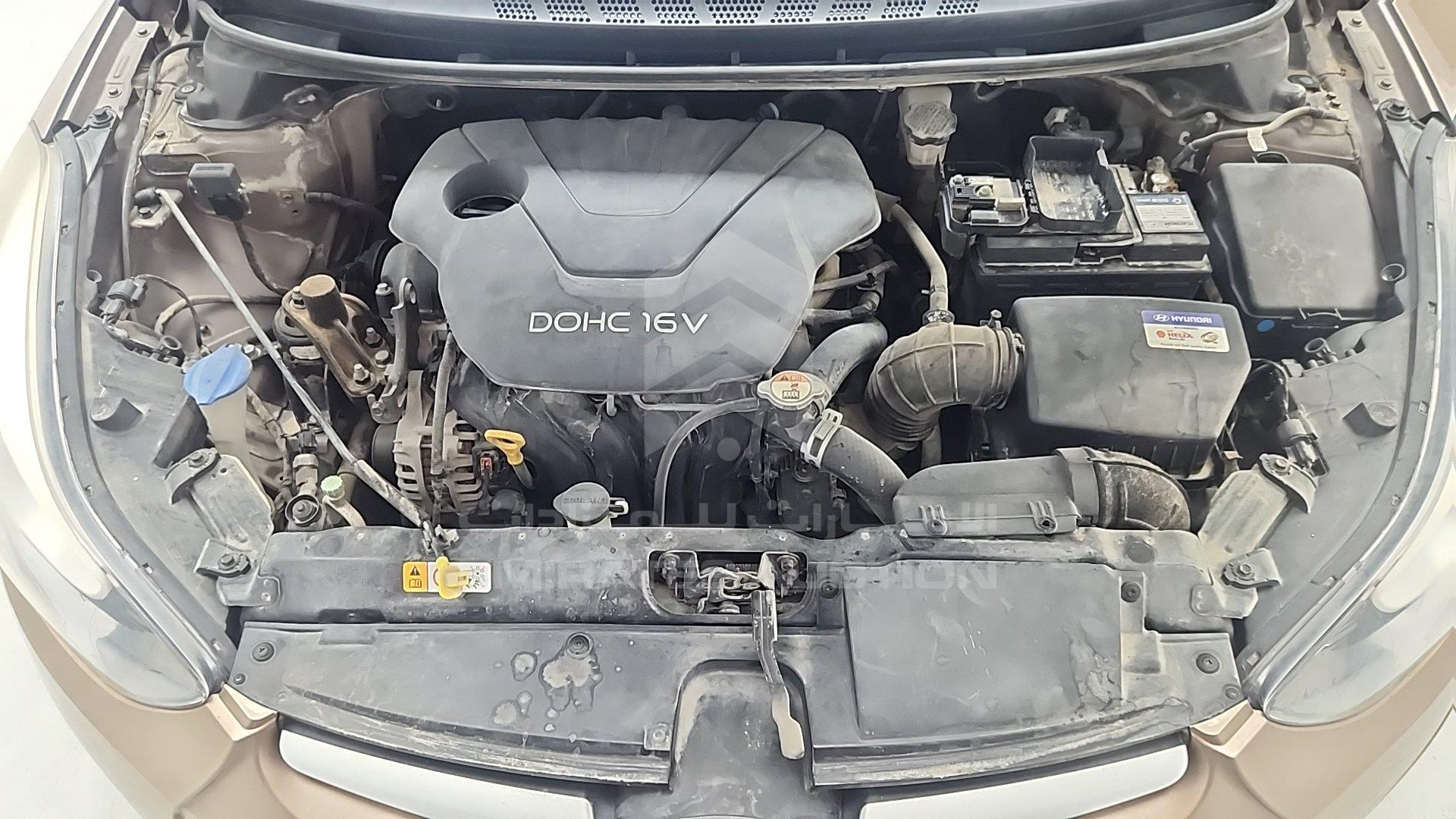 KMHDG41C7FU404715 - 2015 Hyundai Elantra - #504679